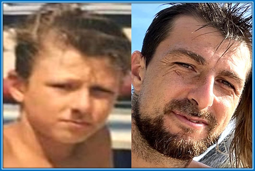 From Beating Testicular Cancer to Triumph: Francesco Acerbi's Story